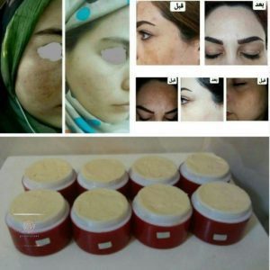 تاثیر کرم معجزه بر پوست
