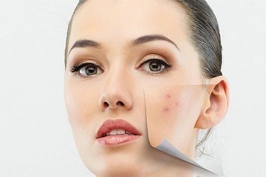 قیمت کرم یونیک