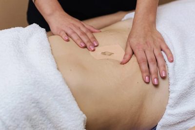 چسب و قرص لاغری ناف